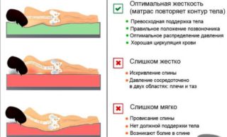 Как правильно спать при шейном остеохондрозе фото на подушке