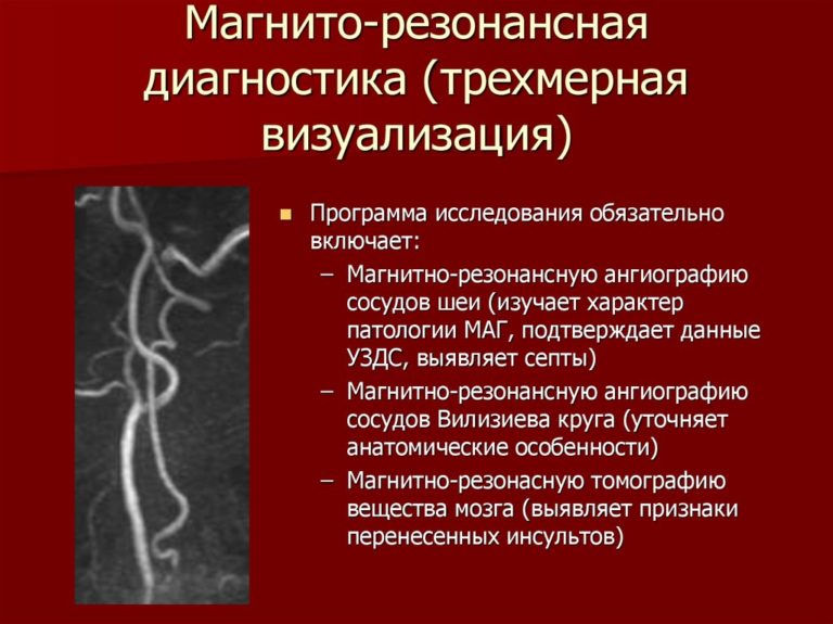 Синдром позвоночной артерии карта вызова скорой медицинской