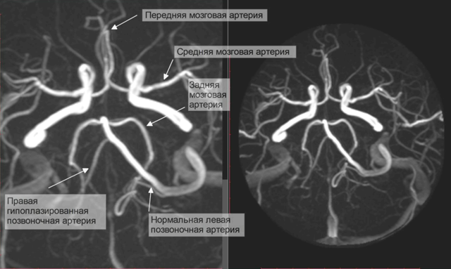 Сегменты вса схема мрт