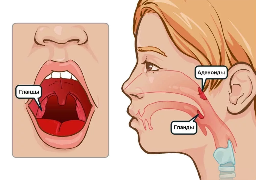 Миндалины глоточного кольца рисунок