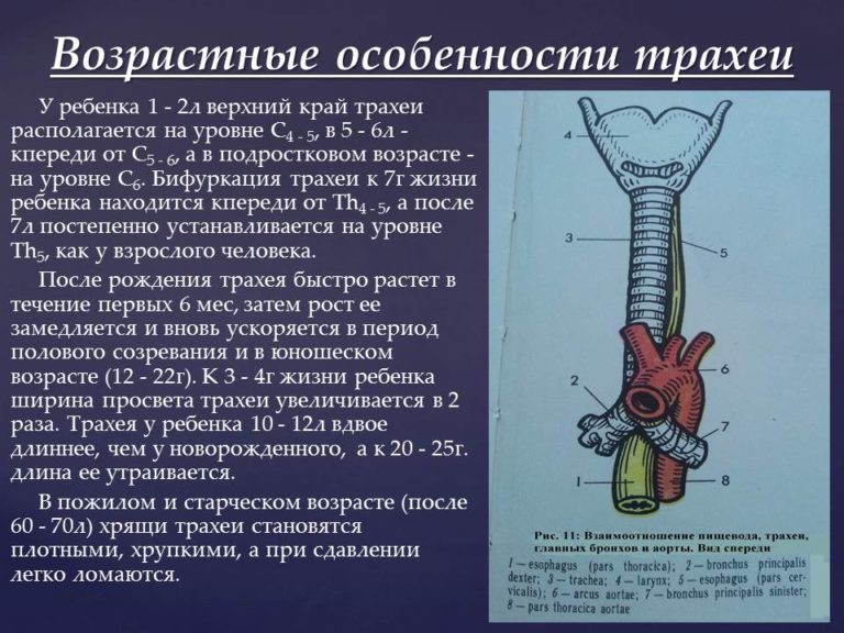 Бифуркация трахеи карина