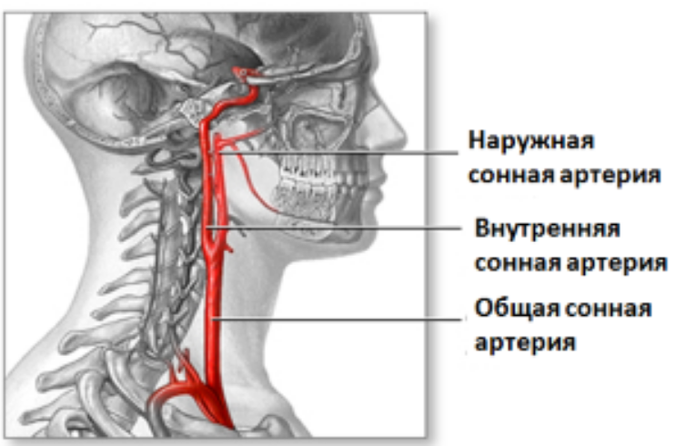 Где находится сонная артерия слева. Внутренняя Сонная артерия на шее. Аневризма сонной артерии.