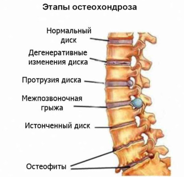 Болит шея когда сижу за компьютером