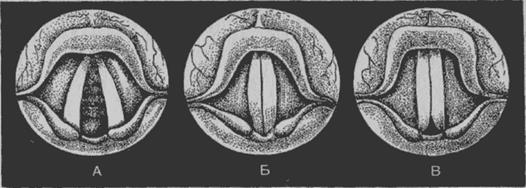 Голосовые связки у человека фото