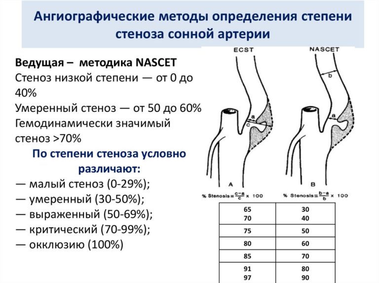 Стенозирующий ларингит карта вызова