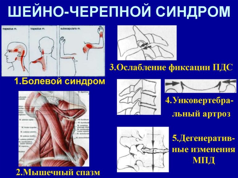 Шейно воротниковая зона фото что входит