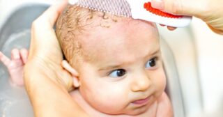 Молочные корочки на голове у ребенка 4 года