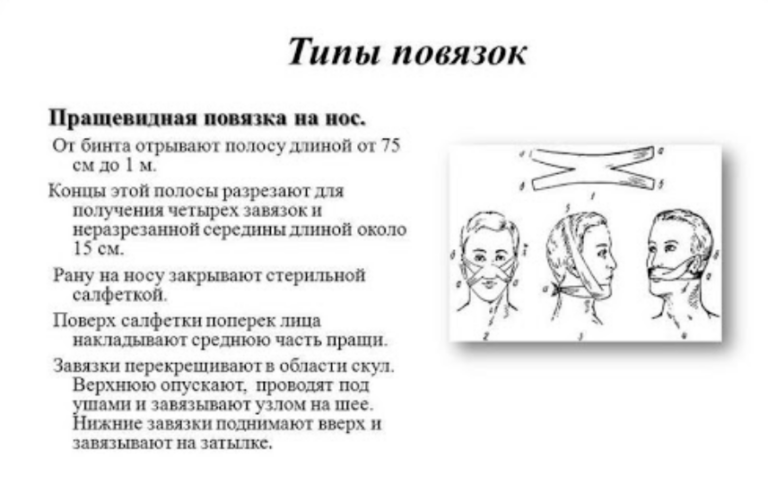 Пращевидная повязка на нижнюю челюсть: как сделать бандаж для челюсти ...