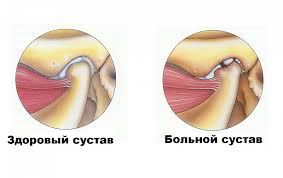 Срок восстановления разрыва и растяжения связок голеностопного сустава