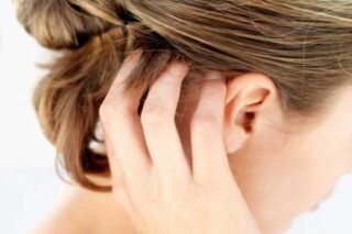 Наросты на голове в волосах у мужчин причины и лечение