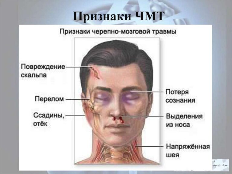 Скальпированная рана головы фото