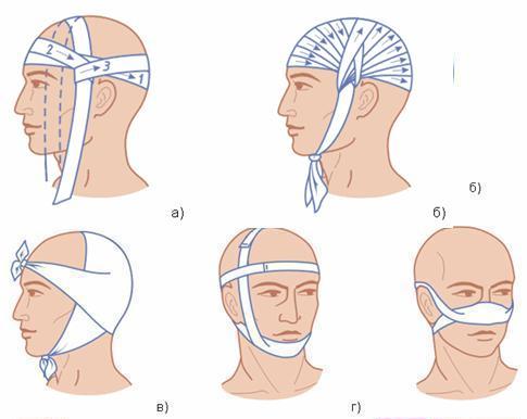 Как бинтовать голову бинтом пошагово с фото