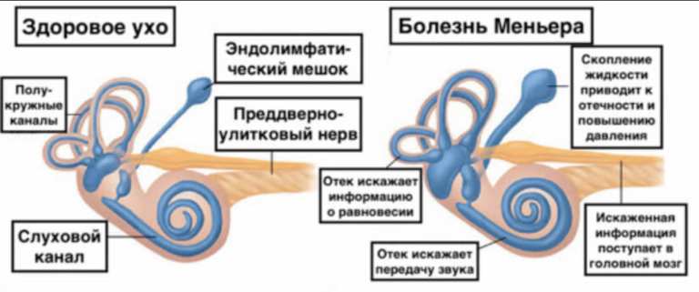 В каких местах можно прокалывать ухо схема