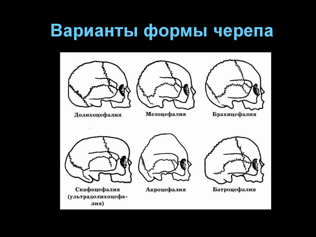 Варианты формы черепа. Форма черепа. Формк черепа. Нормальная форма черепа. Типы формы черепа человека.