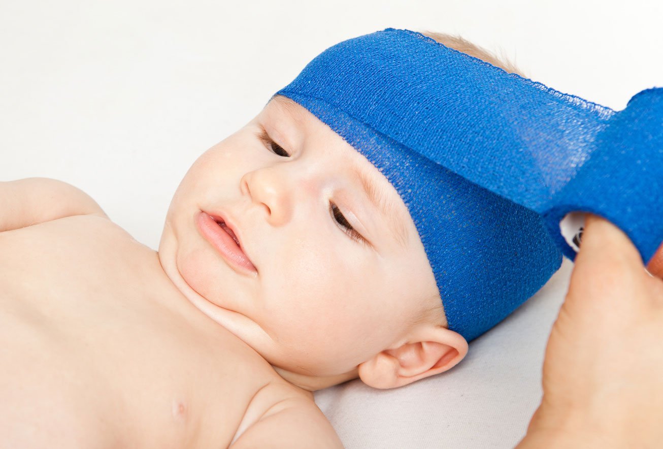 Сотрясение мозга у детей до года. Травмы головы новорожденного. Тарвмв головы у ребенка. Повязка на голову новорожденному лечебная.