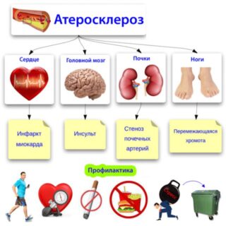 Причины резкого головокружения и онемения конечностей