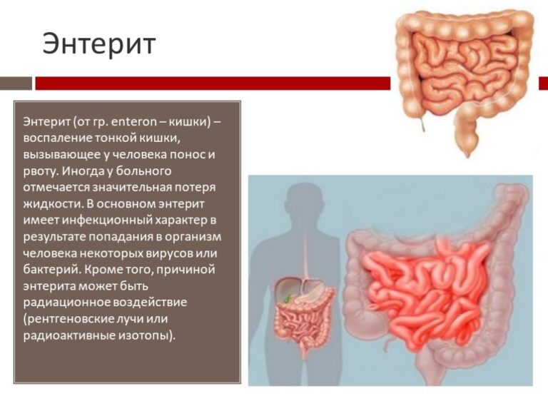 Тошнота и головокружение при подъеме с кровати