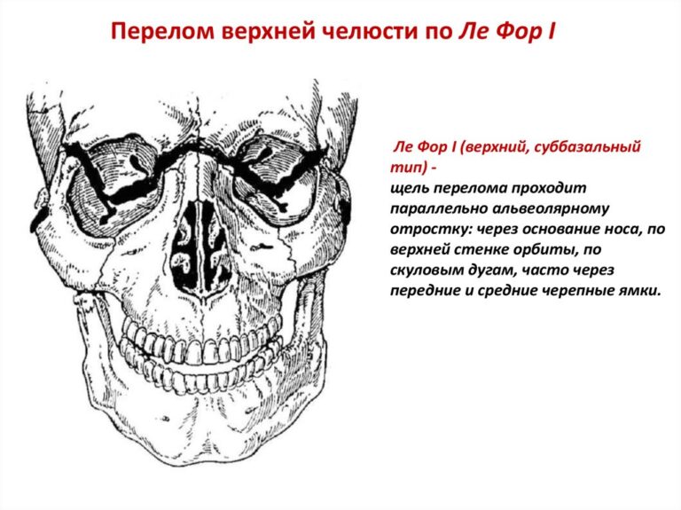 Тяжелая нижняя челюсть большой рот и короткий вздернутый нос фото