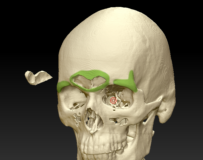 Лоб кость. Надбровные дуги. Асимметрия костей черепа.