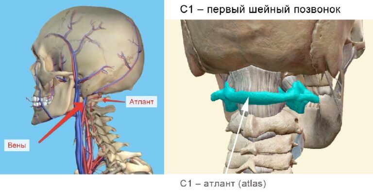 Звенит под капотом