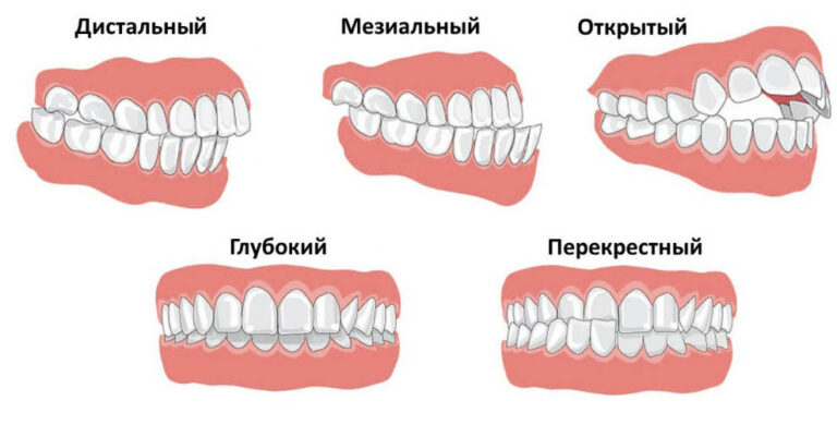 Как нарисовать челюсть с зубами