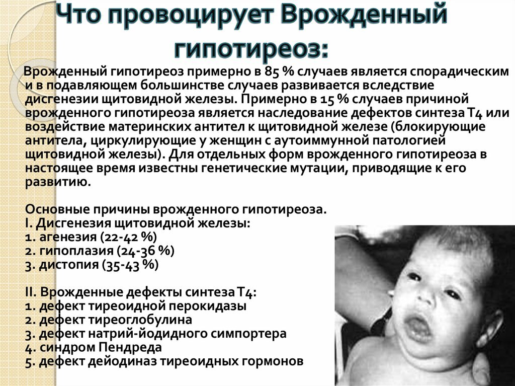 Врожденный гипотиреоз лечение. Врожденный гипотиреоз у детей. Врожденный гипотиреоз у новорожденного. Врожденный гипотиреоз симптомы.