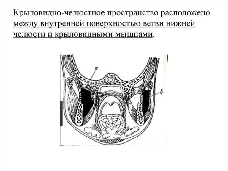 Наращивание височной зоны фото