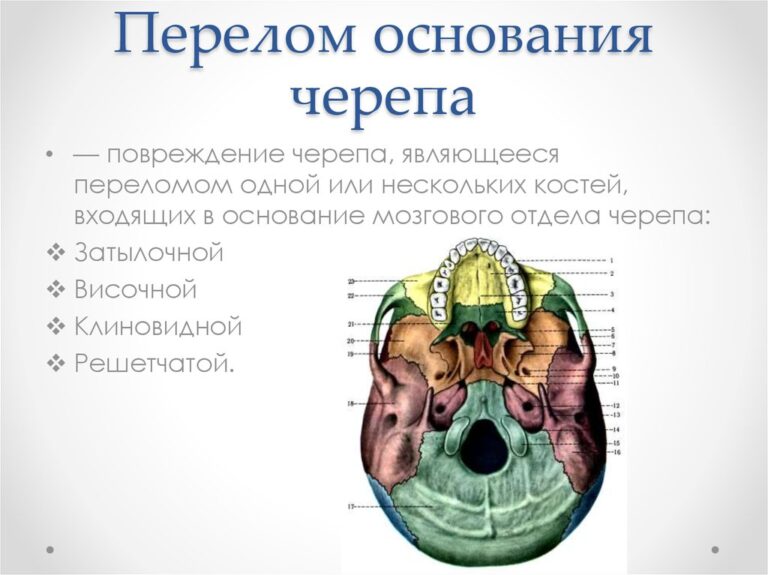 Аксональное поражение моторных волокон