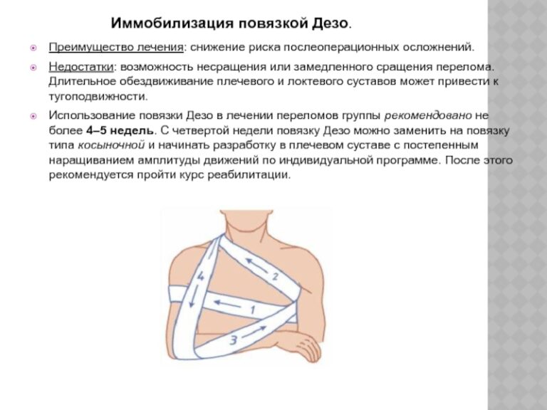 Гипс дезо на плечевой сустав фото