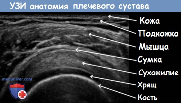 Протокол узи плечевого сустава образец