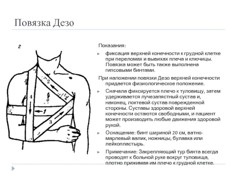 Как правильно спать при переломе плеча картинки