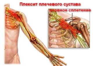 Неврит лицевого нерва карта вызова смп локальный статус