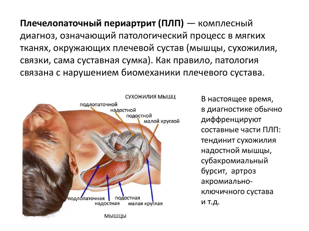 Диагноз по картине