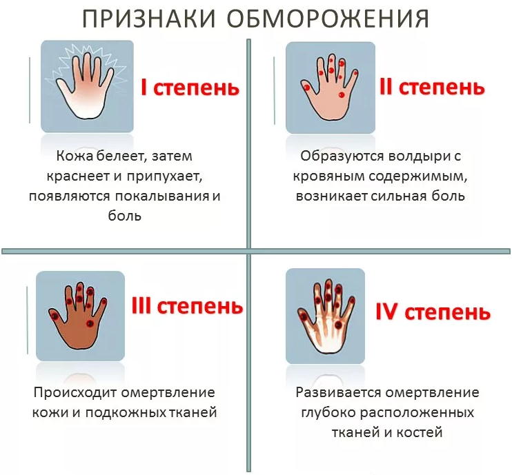 Признаки обморожения ответы сдо. Характерные признаки отморожения III степени. Обморожение и отморожение. Клинические проявления отморожения 1 степени. Обморожение 2 степени признаки.