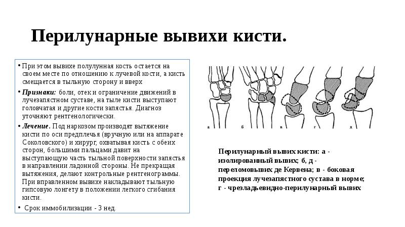Травматическая ампутация ногтевой пластины карта вызова