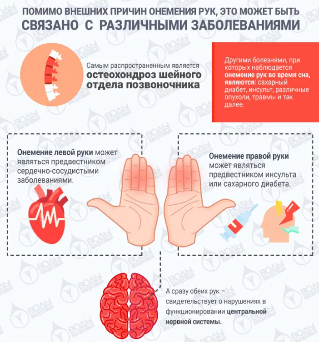 Пальцы потеряли чувствительность. Онемение пальцев рук причины. Почему немеют руки.