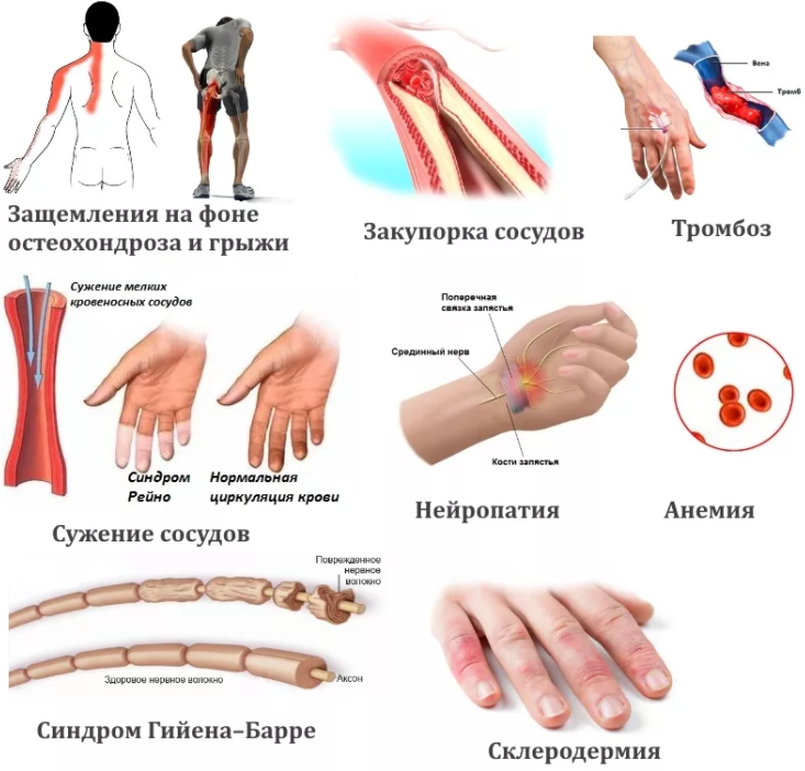 Картинка рука от плеча