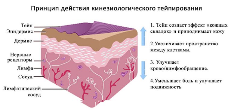 Схемы тейпирования тела