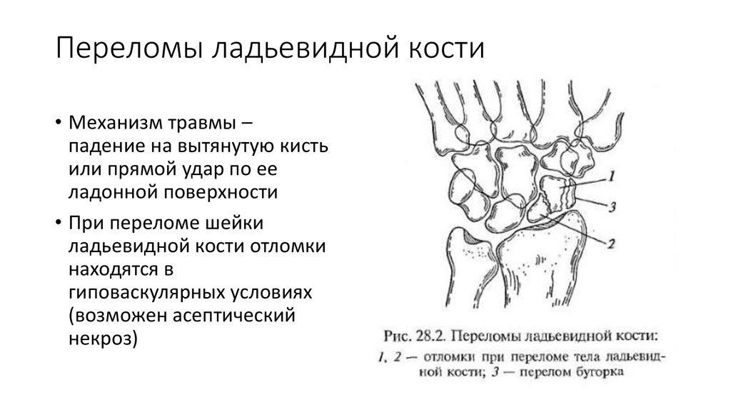 Перелом пальца карта вызова