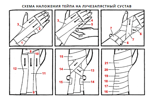 Тейпирование запястья при боли в суставе схема