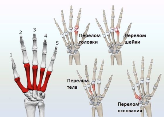 Ладьевидная кость кисти фото