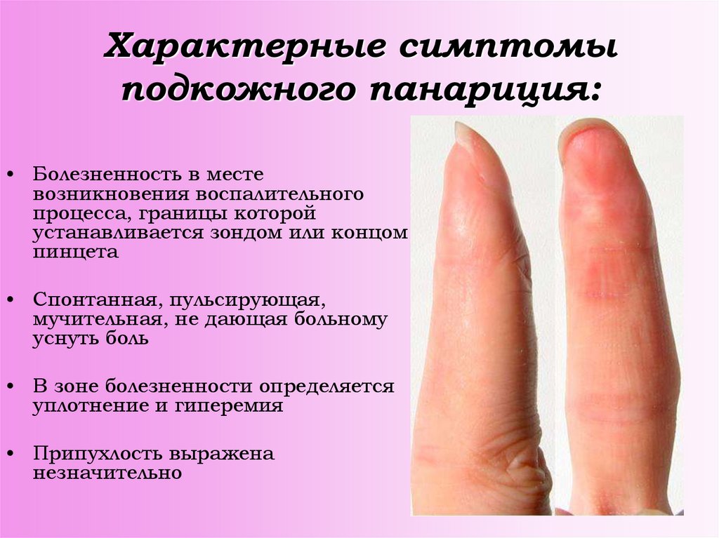 Панариций на пальце руки: что это такое, симптомы, как быстро вылечить .