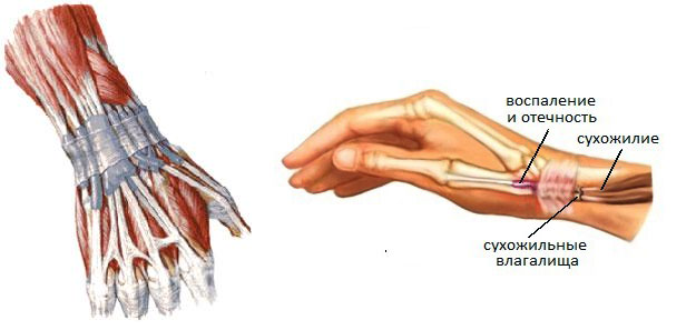 Сухожилия кисти руки фото