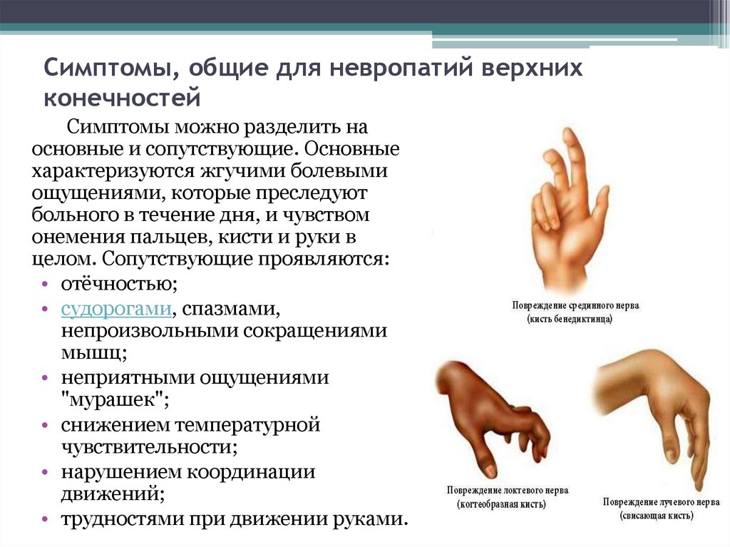 Нейропатии нервов руки. Синдромы поражения срединного нерва. Симптомы поражения срединноонерва. Полинейропатия верхних конечностей. Нейропатия срединного нерва.